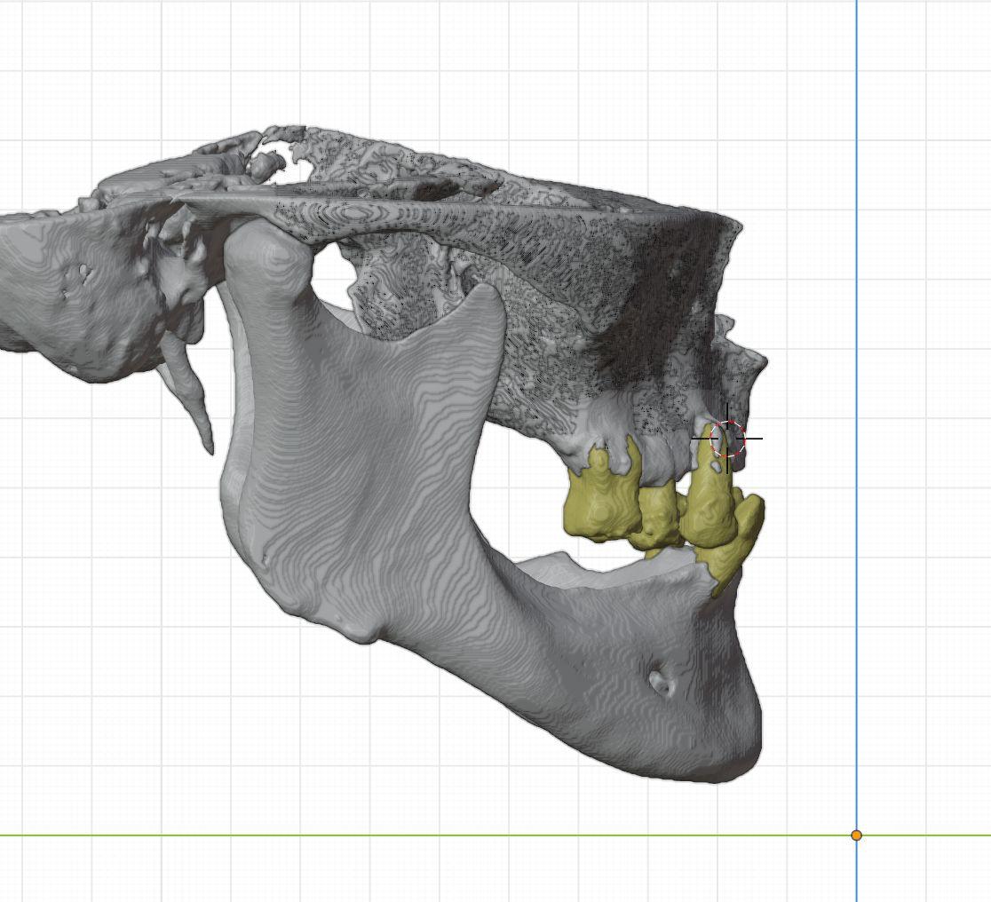 Segunda vista lateral del modelo digital maxilofacial